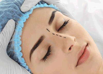 ترمیم بینی جراحی شده؛ چرا بینی شما نیاز به ترمیم دارد؟