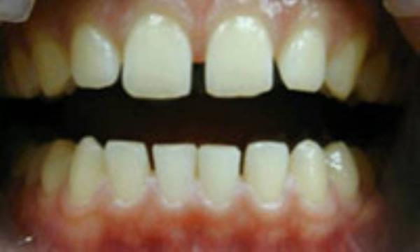 مسائل فک و دندان