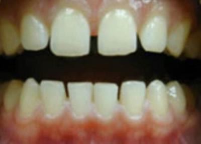 مسائل فک و دندان